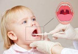 red throat in a child