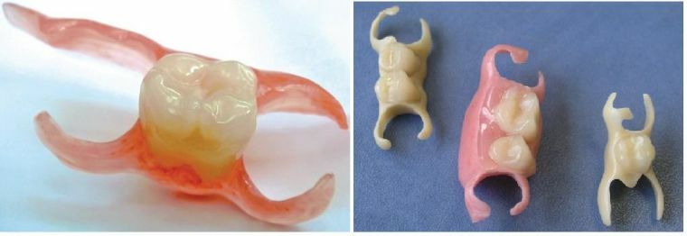 Removable denture Butterfly: the ideal solution for replacing one or two teeth