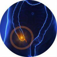 Signs and treatment of appendicitis in adults and children