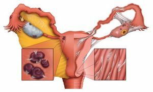 proceso patológico en los testículos