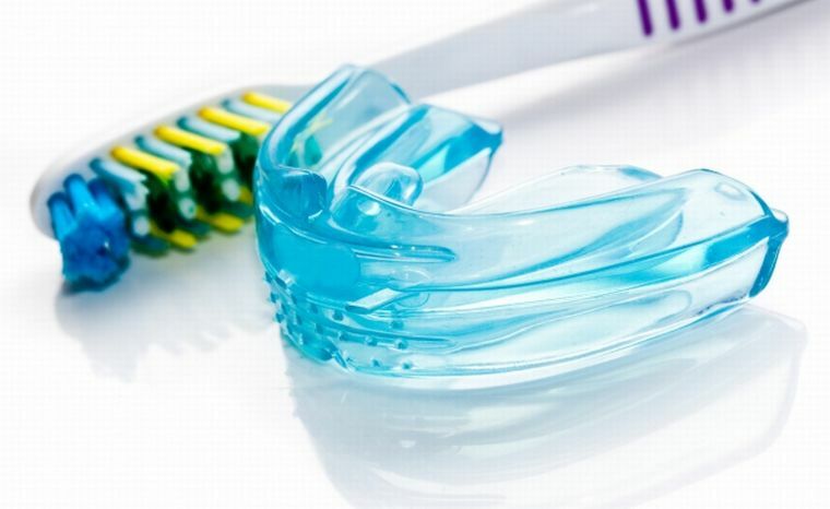 Kapa - plaat hammaste joondamiseks ja hammustuskorrektuur