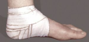 occlusief verband
