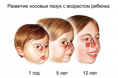 development of maxillary sinuses in children