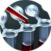 Analys för antimulylerovhormon - indikatorer och orsaker till avvikelser