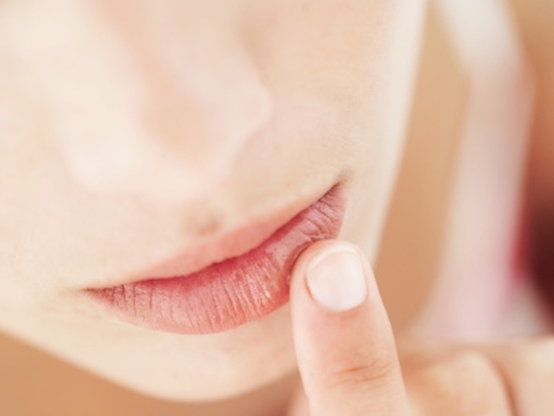 Kakšne so ustnice opraskane: znaki. Kakšna je zgornja ustnica?
