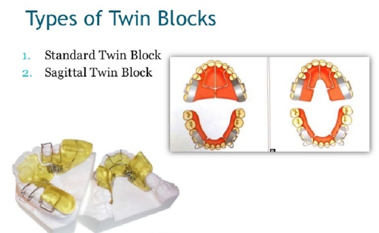 Twin Block - Ortodontisk enhet for korreksjon av okklusjon
