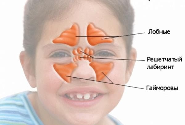 sinusitis kod djeteta 3 godine simptoma