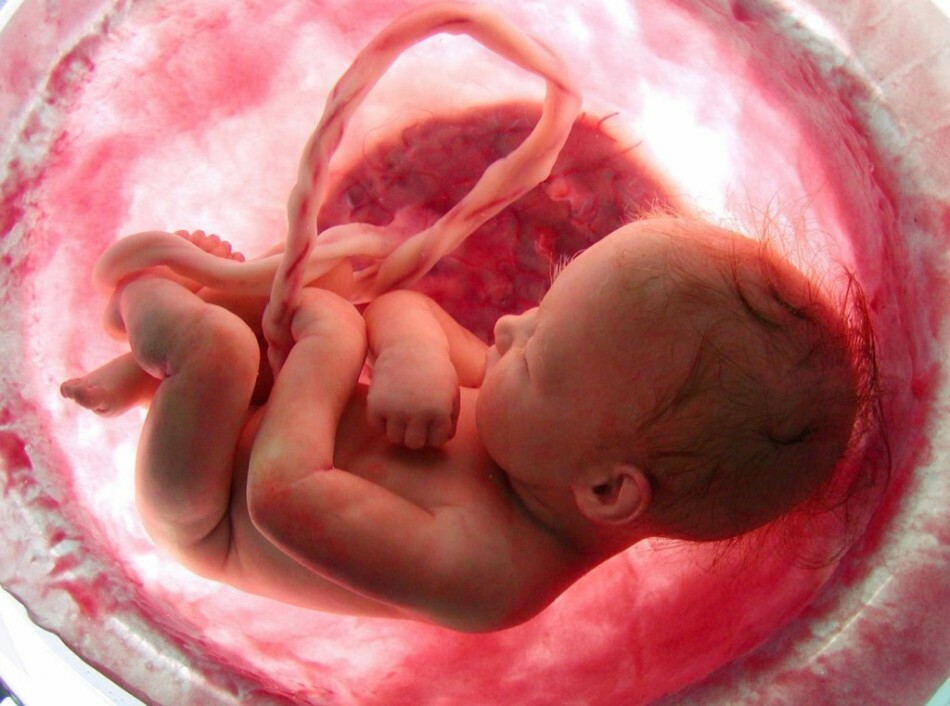 Lotus narodenia: dieťa a placenta. Lotus narodenia: názor lekárov, recenzie