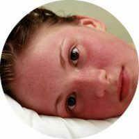 Was ist Hauthyperämie und wie behandelt man sie?
