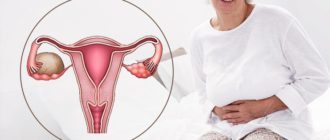 Ovarialzyste in der Menopause