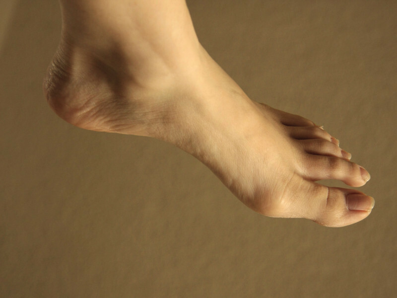 Mengapa ada kerucut dan tulang pada jari kaki? Cara mengobati benjolan pada jempol kaki tanpa operasi: dana dari kerucut di kaki
