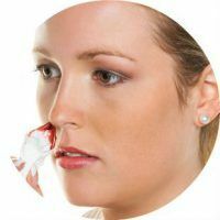 גורם לדימום באף, עזרה ראשונה, טיפול ומניעה