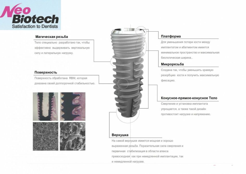 Avantajele implanturilor coreene NeoBiotech