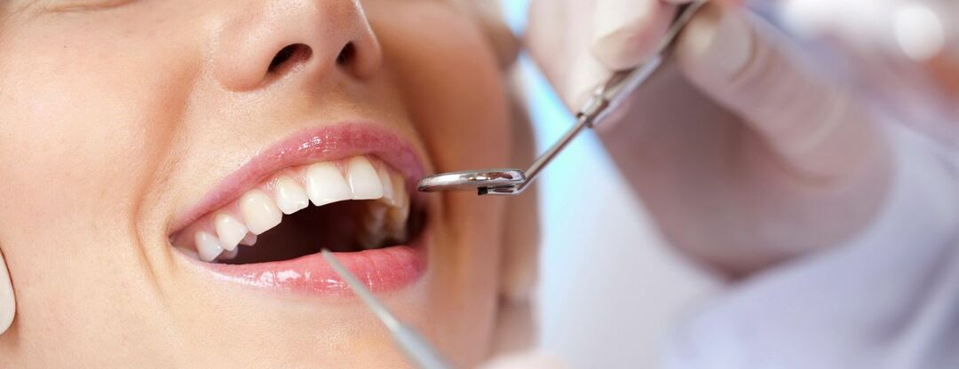 Wat is een tandheelkundige microvsthesis: typen, stadia, voordelen