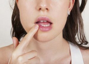 Przyczyny, leczenie i zapobieganie zapaleniom jamy ustnej podczas ciąży