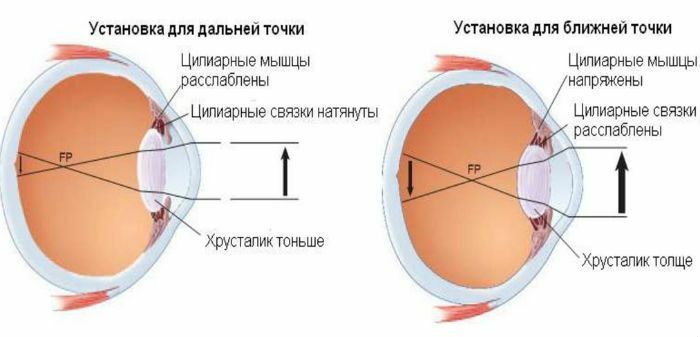 Jak leczyć zaburzenia oka zakwaterowanie u dzieci i dorosłych
