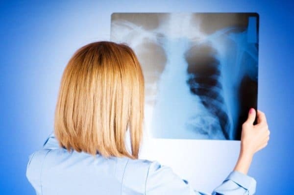 symptom på kronisk bronkit hos vuxna