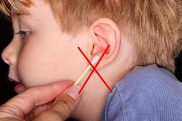 Sivi čepovi u ušima: kako to ispravno ukloniti