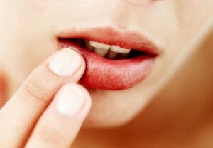Zakaj otekle ustnice in kako hitro odstraniti vnetje