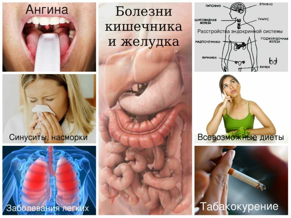 Suuõõne tabletid: halitoosist tingitud vahendite toime ja efektiivsus