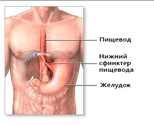 Vedvarende udvidelse af spiserøret og spiserøret af phlebectasia