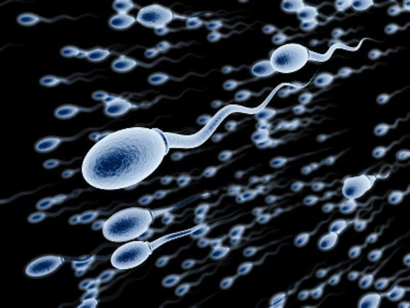 Infertility in men. Analysis for infertility. Treatment of male infertility