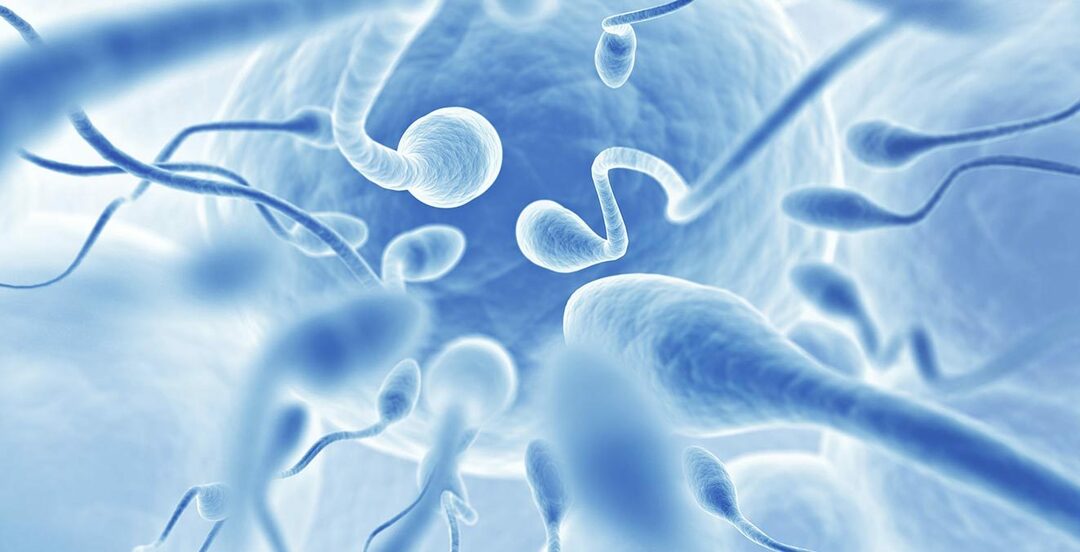 Infertilidad masculina - azoospermia.¿Es posible la azoospermia o el embarazo? Tratamiento de la azoospermia