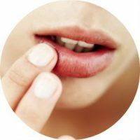 How to treat seizures and cracks in the corners of the lips