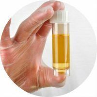 What does it mean if leukocytes are found in the urine or leucocyturia