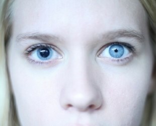 Anisocorie de la maladie rare des yeux