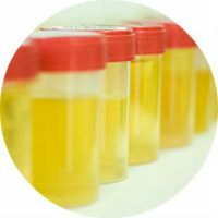 Hoe te gebruiken, ontcijfer de resultaten van urineonderzoek in Zimnitskiy