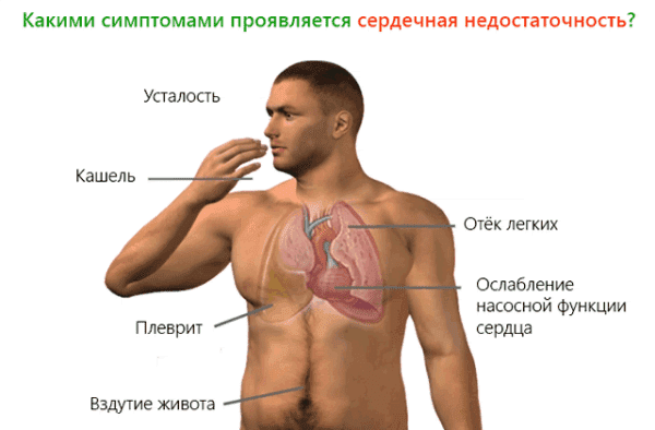 Causes and treatment of coughing appearing after running