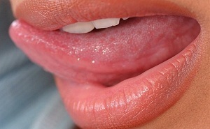 דלקת הלשון והפפיליות שלה: גורם וטיפול
