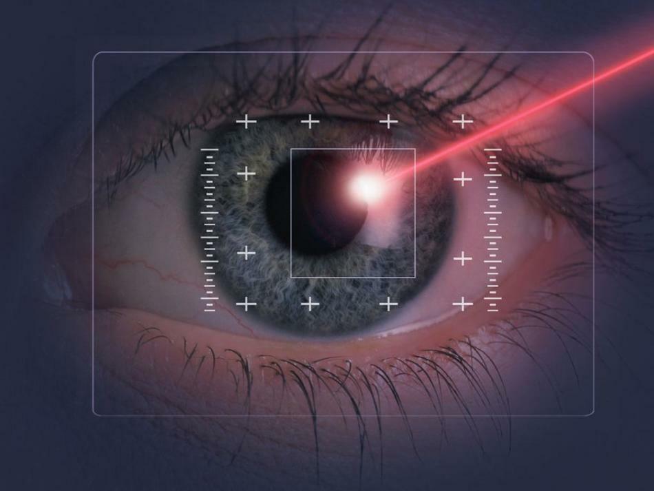 Laserzichtcorrectie: aanbevelingen en contra-indicaties. Sinds hoeveel jaar kan ik een operatie uitvoeren om myopie te corrigeren en in welke mate?