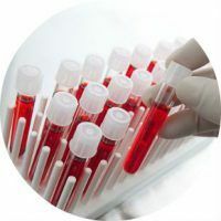 A felnőttkori vér biokémiai analízisének valamennyi paraméterének részletes értelmezése