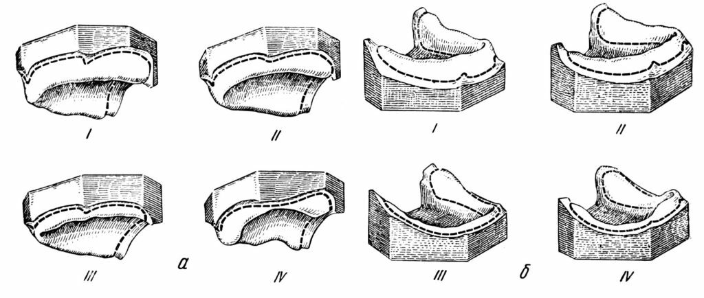 Vrste in značilnosti klasifikacij čeljusti brez zob