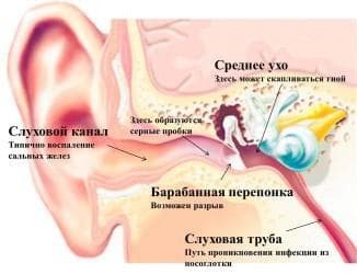 objawy zapalenia ucha środkowego na dorosłych zdjęciach