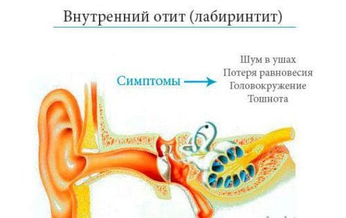 Symptoms of ear diseases in adults and their treatment
