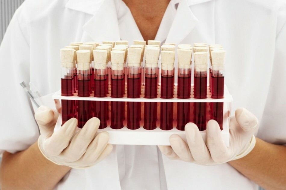 Rhesuskonflikt über die Blutgruppe: Symptome, Ursachen, Behandlung. Wie wird der Rh-Faktor bestimmt? Kompatibilität der Blutgruppen: Tabelle