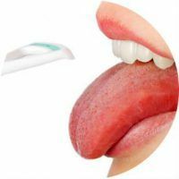 Causas y métodos de tratamiento de llagas en la boca