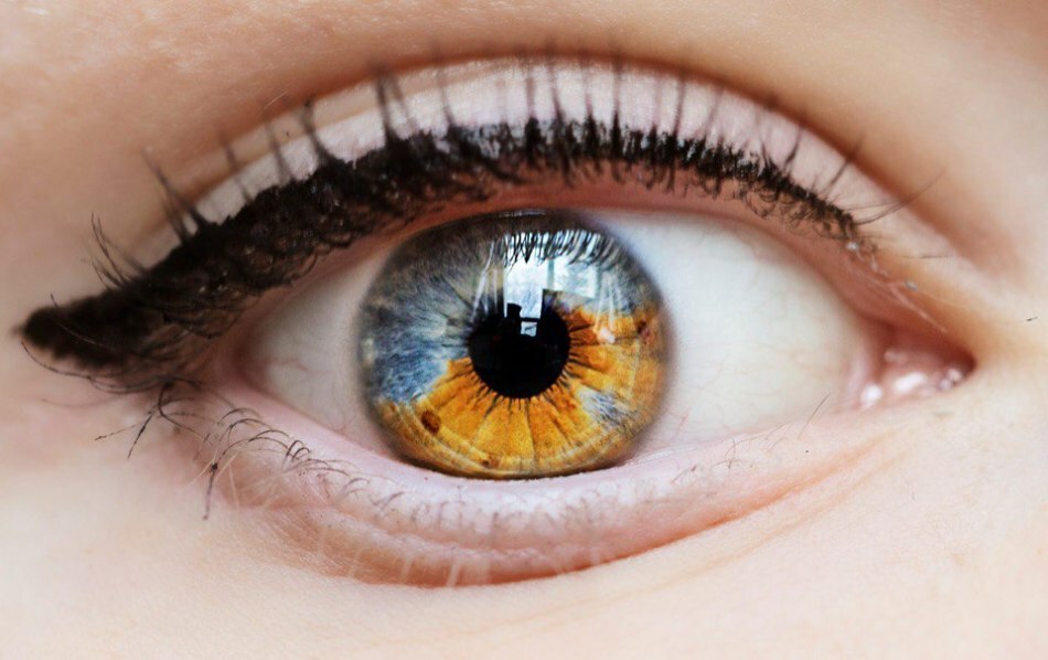 Kāda ir acs heterohromija? Kāpēc cilvēku dažādu krāsu acis: iemesli