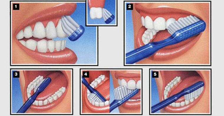 Quando, quantas vezes por dia e como corretamente escovar os dentes?