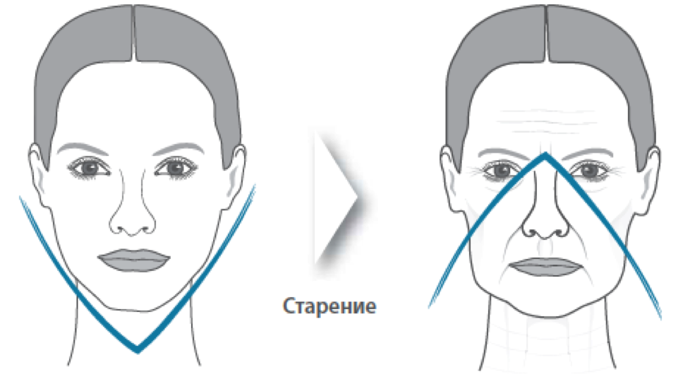 Types of facial aging and their characteristics. Aging of the face skin in women: causes, early signs, prevention
