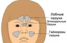 druppels in de neus met sinusitis en sinusitis