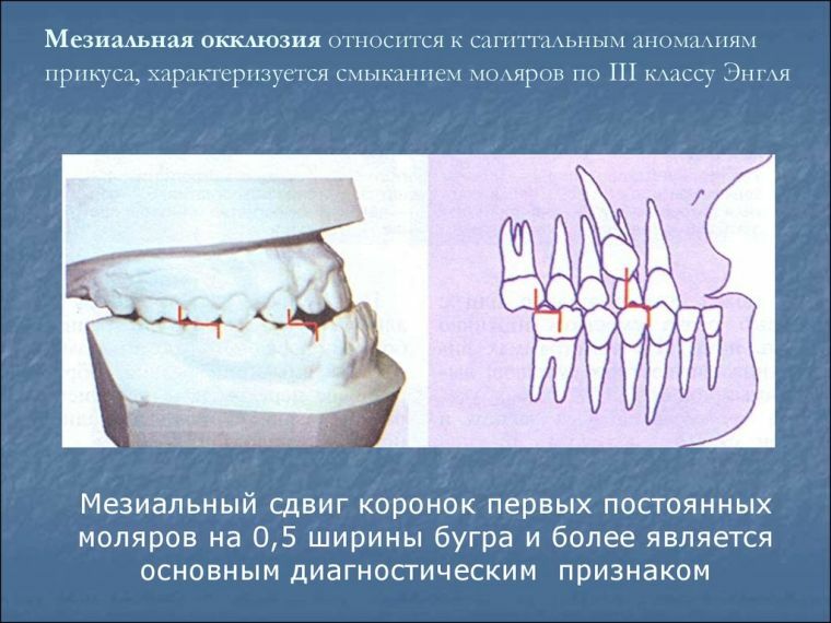 Ocklusion och dess avvikelser i tandläkare