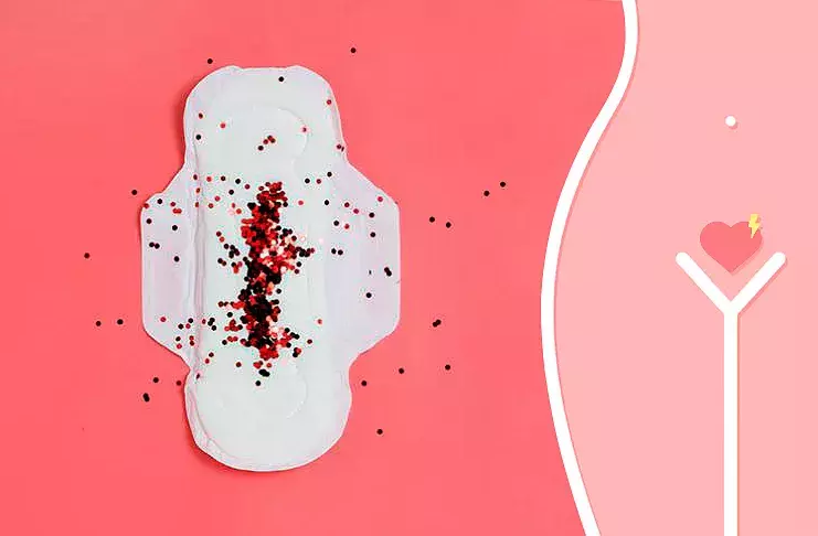 Bloedstolsels tijdens de menstruatie (oorzaken): er komen stolsels uit die lijken op de lever (stukjes endometrium)