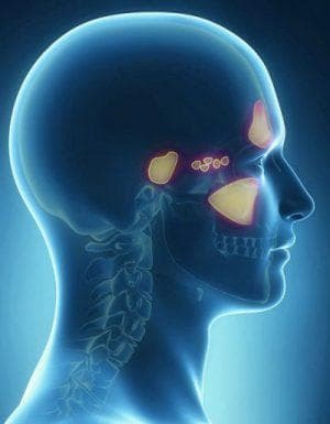 chronische sinusitis