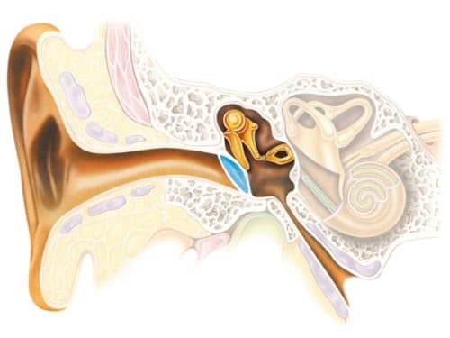 conductive hearing loss