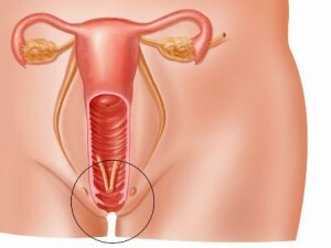 Carrying out the plasticity of the cervix when it goes down