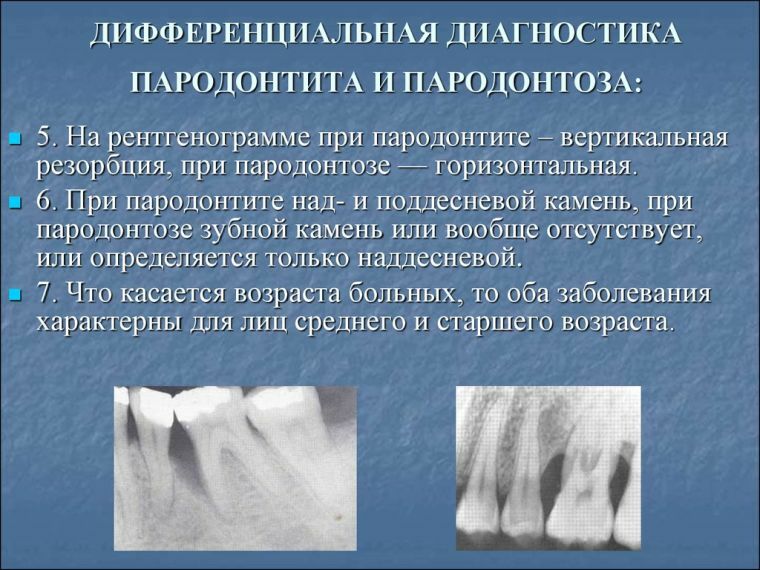 Diagnosis penyakit periodontal: pendekatan dan metode modern